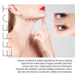 Kem dưỡng Retinol Kem nám tàn nhang chấm tàn nhang kem trắng da mặt 30g Loại bỏ nám tàn nhang làm trắng sáng da dưỡng ẩm