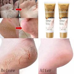 Kem dưỡng chân Kem dưỡng da tay Kem Chống Nẻ 60g Dưỡng Ẩm Chống Nẻ Da Tay Chân á sừng Bong da Nứt Gót Chân