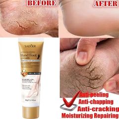 Kem dưỡng chân Kem dưỡng da tay Kem Chống Nẻ 60g Dưỡng Ẩm Chống Nẻ Da Tay Chân á sừng Bong da Nứt Gót Chân