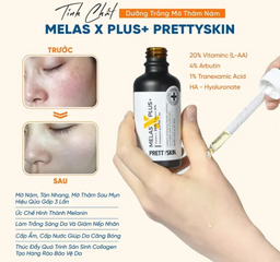 Tinh Chất Dưỡng Trắng Mờ Thâm Nám Pretty Skin Melas X Plus+ - Chuyên Sâu Với 20% Vitamin C, Arbutin & HA, Dưỡng Da Sáng Mịn, Giúp Da Khỏe Mạnh