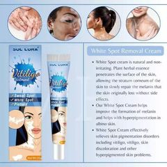 Kem Bôi Bạch Biến Kem Lang Ben Mờ Đốm Trắng, Nâu Đốm Trắng Giúp Da Đều Màu