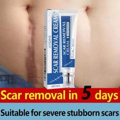 Kem mờ sẹo mờ thâm sẹo lồi sẹo lõm sẹo do mụn và giảm rạn da hiệu quả 30ml nhanh chóng làm mờ sẹo lồi sẹo lõm