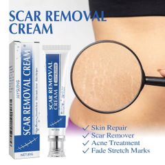 Kem mờ sẹo mờ thâm sẹo lồi sẹo lõm sẹo do mụn và giảm rạn da hiệu quả 30ml nhanh chóng làm mờ sẹo lồi sẹo lõm