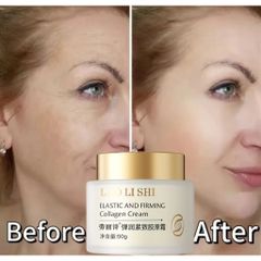 Kem Xoá Nếp Nhăn Trẻ Hoá Da Mờ Nám Tàn Nhang Chống Chảy Xệ Bổ Sung Collagen Cream