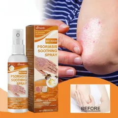 Xịt Giảm Ngứa giảm ngứa tức thì, viêm da cơ địa, nấm, ngứa... hiệu quả