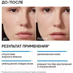 💗 Icon Skin Kem Dưỡng Da Moist And Heal Anti Acne Cream 30ml – Dưỡng Ẩm, Giảm Mụn, Làm Dịu Da, Phù Hợp Da Hỗn Hợp Và Dầu