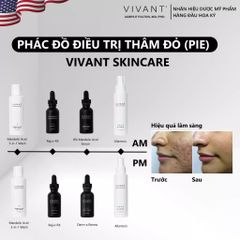 💗 Vivant Kem Dưỡng Ẩm Allantoin Sedating & Hydrating Lotion Phục Hồi Da, Giảm Kích Ứng, Chống Oxy Hóa, Làm Dịu Da