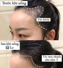 Viên uống mọc tóc Nutri D-DAY Premium Biotin 10000 Korea 90 viên 737611