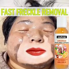 Nước lột da,Tinh chất Lột ,Tẩy tế bào chết body,thay da sinh học 100ml Orange Peeling Oil