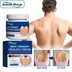 Kem Giảm Ngứa 20g Xịt chống ngứa Xịt bệnh chàm bệnh vảy nến hắc lào mề đay lang ben á sừng viêm da nấm giảm ngứa