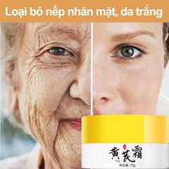 Kem xóa tàn nhang 70g kem ngừa nám Chuyên sâu Loại bỏ các đốm đen Sắc tố làm sáng da Săn chắc da kem dưỡng ẩm cho mặt