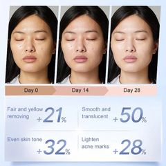 Kem xóa tàn nhang 70g kem ngừa nám Chuyên sâu Loại bỏ các đốm đen Sắc tố làm sáng da Săn chắc da kem dưỡng ẩm cho mặt