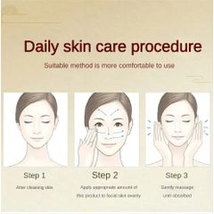 Kem xóa tàn nhang 70g kem ngừa nám Chuyên sâu Loại bỏ các đốm đen Sắc tố làm sáng da Săn chắc da kem dưỡng ẩm cho mặt