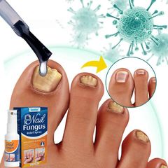 Bình xịt Loại Bỏ Nấm Móng Chống Nhiễm Trùng Cho Móng Chân Kháng Khuẩn Sửa Chữa Nhiễm Trùng Chăm Sóc Bàn Chân