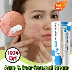 AZELAIC ACID Kem chấm mụn bỏ các loại mụn, mụn đầu đen,mụn ở tuổi dậy thì,loại bỏ mụn bọc cho da dầu