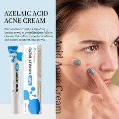 AZELAIC ACID Kem chấm mụn bỏ các loại mụn, mụn đầu đen,mụn ở tuổi dậy thì,loại bỏ mụn bọc cho da dầu