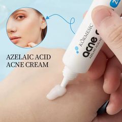 AZELAIC ACID Kem chấm mụn bỏ các loại mụn, mụn đầu đen,mụn ở tuổi dậy thì,loại bỏ mụn bọc cho da dầu