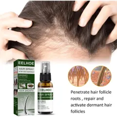 Xịt Mọc Tóc , Giảm Rụng Tóc Và Kích Thích Mọc Tóc