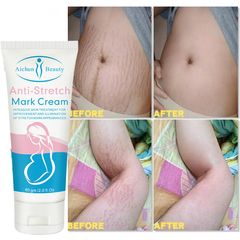 [Loại Bỏ Sẹo] Kem Xóa Sẹo Nhanh Chóng, Vết Bỏng, Sẹo Trầy Xước, Sẹo Sau Phẫu Thuật, Vết Rạn Da