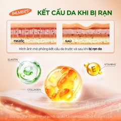 Size mini 50ml Lotion ngăn và làm mờ rạn da cho mẹ bầu Palmer's Cocoa Butter  Pregnancy Massage Lotion For Stretch Marks