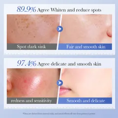 Kem Trắng Da Dưỡng Ẩm Chốngg Lãoo Hóaa Chiết Xuất 30ml Giúp Da Trắng Sáng