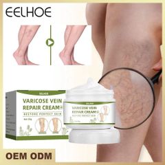 Kem Giảm Suy Giãn Tĩnh Mạch