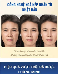 Kem Xoá Nếp Nhăn, Chống Chảy Xệ Qinglin Làm Mờ Nếp Nhăn, Trẻ Hoá Da, Se Khít Lỗ Chân Lông, Xóa Nám Tàn Nhang