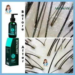Xịt dưỡng tóc, giảm viêm da đầu Đài Loan AROMASE Herbal Cooling Scalp Care Spray 40ml - cho da dầu
