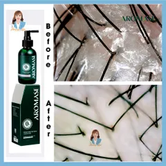 Xịt dưỡng tóc, chăm sóc da đầu Đài Loan AROMASE Herbal Scalp Care Spray 40ml - cho da đầu khô