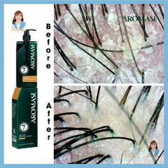 Dầu gội ngăn gàu, giảm nhờn da đầu, ngăn bết tóc Đài Loan AROMASE Oily Scalp Balancing Shampoo 400ml