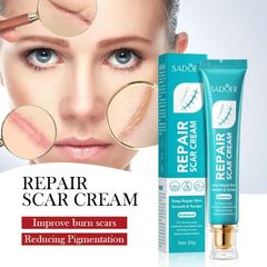 Kem Sẹo 20g - Hỗ Trợ Cải Thiện Sẹo Rỗ, Sẹo Lõm, Làm Mờ Vết Sẹo Thâm, Sẹo Tai Nạn, Sẹo Thủy Đậu