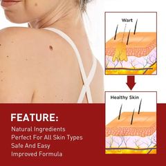 [Loại Xịn]Tẩy nốt ruồi mụn cóc, mụn thịt, dưỡng da, kháng khuẩn, tinh chất thảoo dượcc thiên nhiên, ann toànn