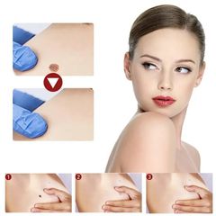 [Loại Xịn]Tẩy nốt ruồi mụn cóc, mụn thịt, dưỡng da, kháng khuẩn, tinh chất thảoo dượcc thiên nhiên, ann toànn