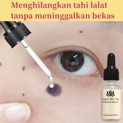 [Loại Xịn]Tẩy nốt ruồi mụn cóc, mụn thịt, dưỡng da, kháng khuẩn, tinh chất thảoo dượcc thiên nhiên, ann toànn