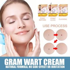 Kem mụn cóc kem tẩy nốt ruồi mụn cóc 50g 7 ngày loại bỏ nốt ruồi mụn cóc mụn thịt nhanh chóng ann toànn và không đau