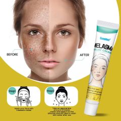 Kem Mờ Nám, Tàn Nhang 20g Trẻ Hoá Da, Kem Dưỡng Trắng Da, Mờ Nám Mảng, Nám Chân Sâu Hiệu Quả