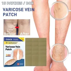 Giãn tĩnh mạch Miếng dán giảm giãn tĩnh mạch giảm mỏi phù nề tê chân giảm nổi gân xanh trên da