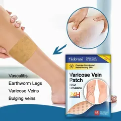 Giãn tĩnh mạch Miếng dán giảm giãn tĩnh mạch giảm mỏi phù nề tê chân giảm nổi gân xanh trên da