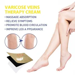 Giãn tĩnh mạch Miếng dán giảm giãn tĩnh mạch giảm mỏi phù nề tê chân giảm nổi gân xanh trên da