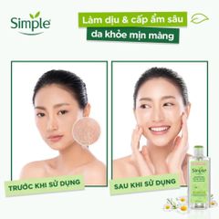 Nước Hoa Hồng Simple Soothing Facial Toner 200ml - Làm Dịu Và Cấp Ẩm Cho Da