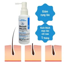 Xịt Minoxidil giảm rụng tóc,giúp tóc chắc khỏe