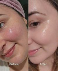 Kem Dưỡng Cân Bằng Hệ Vi Sinh Obagi Rebalance Skin Barrier Recovery -chính hãng thương hiệu Mỹ
