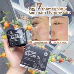Kem nám 𝐌𝐎𝐌𝐘𝐂𝐀𝐑𝐄 chính hãng hàn quốc