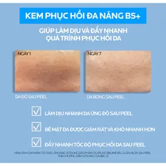 Kem Dưỡng Làm Dịu Da La Roche-Posay Cicaplast B5+ Baume 100ml – Phục Hồi Da, Giảm Kích Ứng