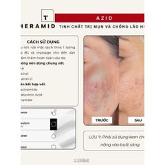 [HÀNG CÔNG TY] TINH CHẤT THERAMID AZID 15% AZELAIC ACID 30ML Giảm Mụn, Mờ Thâm Sáng Da