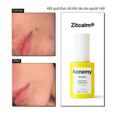 Huyết Thanh ACNEMY ZITCALM SERUM 30ml Dưỡng Ẩm Phục Hồi  Da