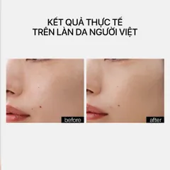 Serum Dưỡng Ẩm Cho Da THERAMID LINO-8 30ml