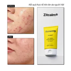 Kem giảm đỏ và làm dịu da ACNEMY CALMING MOISTURIZER 50ml