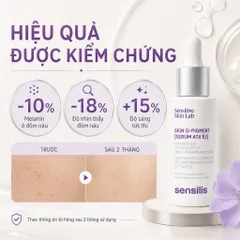 Serum Sensilis Skin D-Pigment ATX B3 30ml Mờ Thâm Nám, Đốm Nâu Cho Da Nhạy Cảm