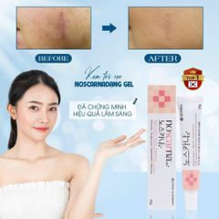 Kem Sẹo NOSCARNA Nội Địa Hàn Quốc - Làm Mờ Sẹo. Tuýp 20g